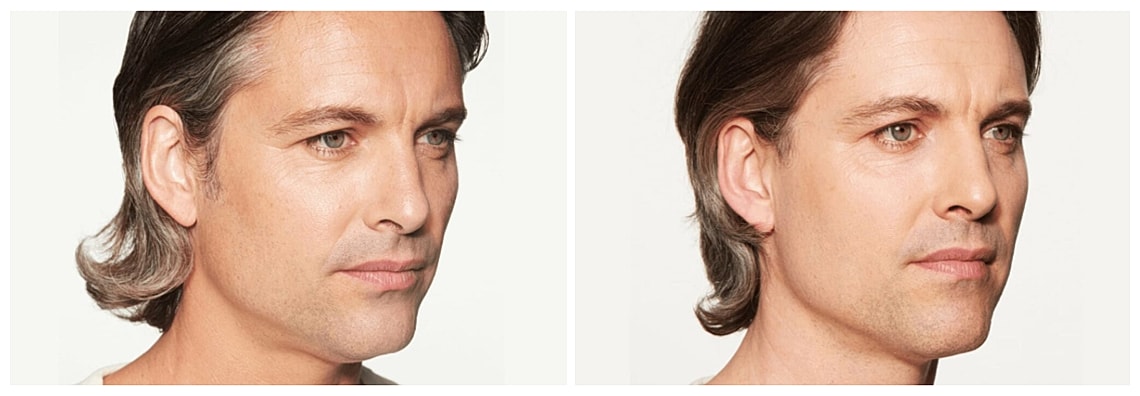 Side profiles of a man with medium-length hair.