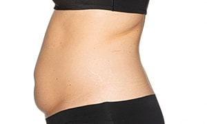 Side view of a woman's exposed abdomen.