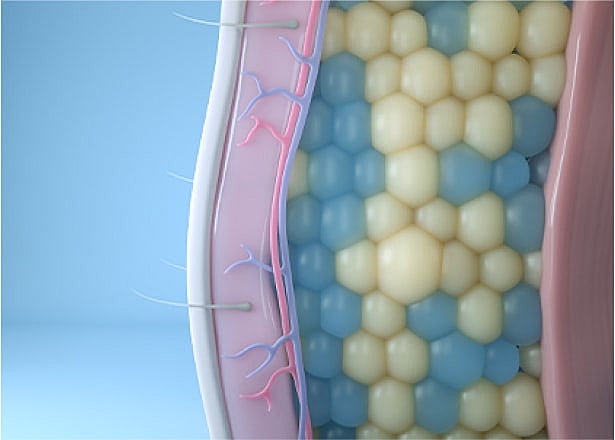 Illustration of frozen fat cells under the skin