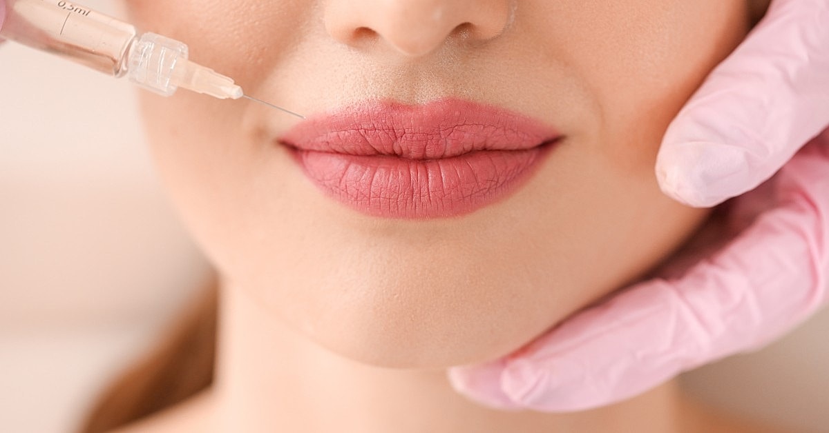 Lip Flip vs Lip Filler: Which Is Better?