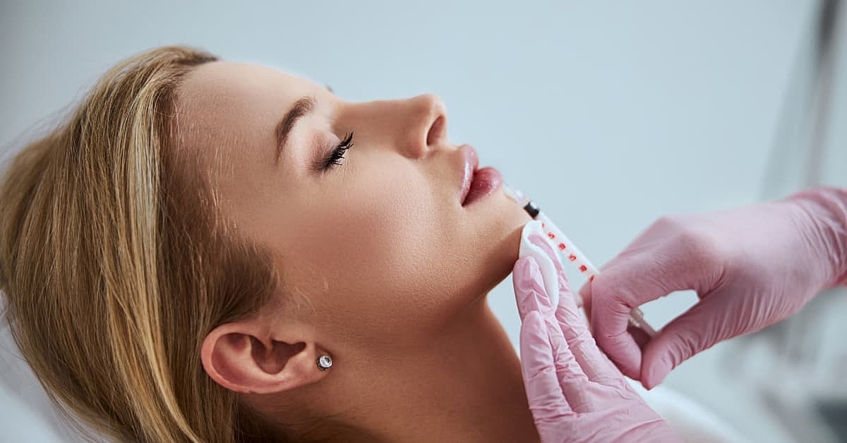 How Long Does It Take for Lip Filler to Settle?